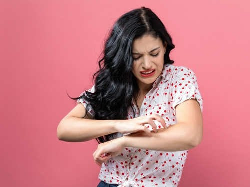 Meo don gian tranh bi muoi dot trong mua mua