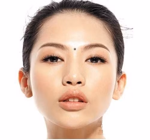 Not ruoi o tran, la hoa hay la phuc?-Hinh-2