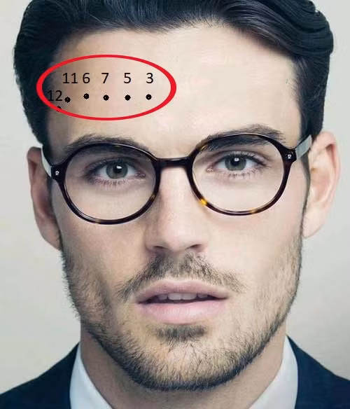 Not ruoi o tran, la hoa hay la phuc?-Hinh-3