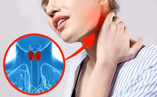 Tin hieu bat thuong cua co the canh bao ung thu dang tien rat gan