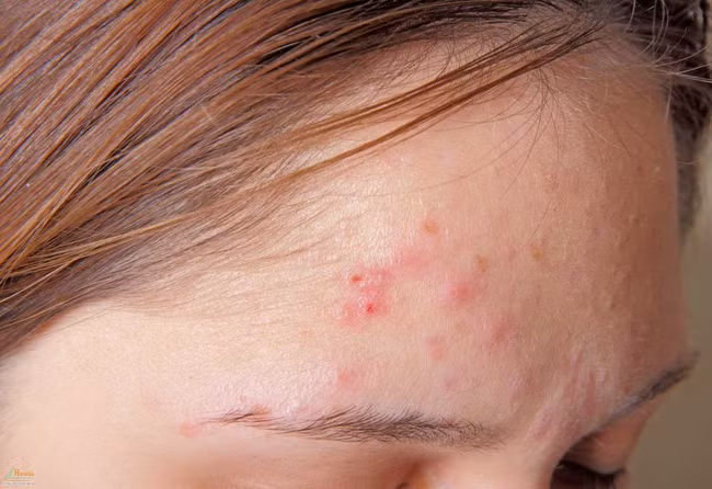 Dau hieu chung to co the ban dang chua “mot o” doc to