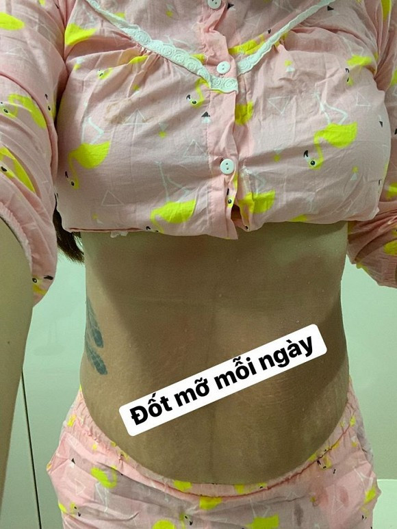 Hải Băng hé lộ hình ảnh bụng chằng chịt vết rạn sau 3 lần sinh - Hình 3 Hai Bang he lo hinh anh bung chang chit vet ran sau 3 lan sinh-Hinh-3