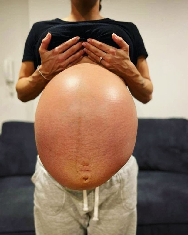 Nhin theo ngon tay cua bac si khi sieu am ba me bat khoc-Hinh-2