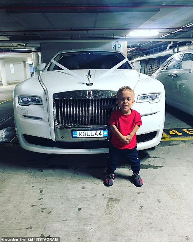 Cậu bé này là Quaden Bayles, sống ở Australia. Em mắc hội chứng achondroplasia làm cho vóc dáng thấp, ngoại hình biến dạng.