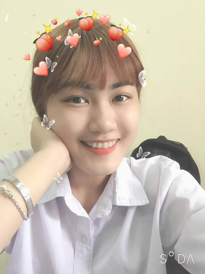 Nữ sinh 18 tuổi mắc ung thư phổi: "chỉ vuốt tóc 15 phút nhưng mình trọc cả mái đầu" - Hình 4 Nu sinh 18 tuoi mac ung thu phoi: