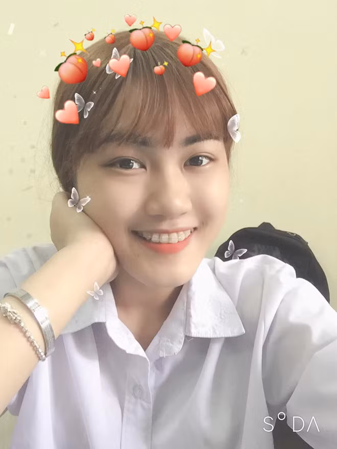 Nu sinh 18 tuoi mac ung thu phoi: 