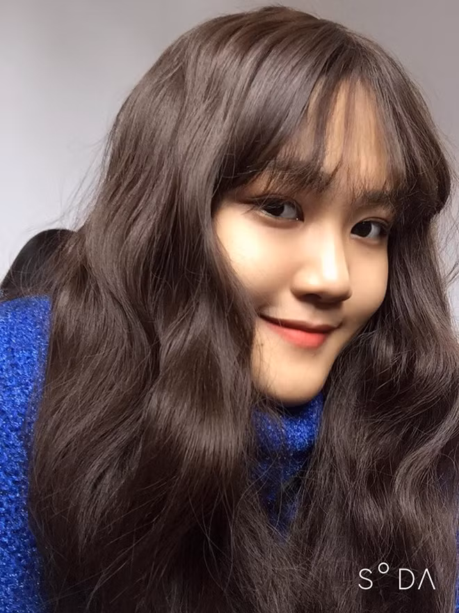 Nu sinh 18 tuoi mac ung thu phoi: 