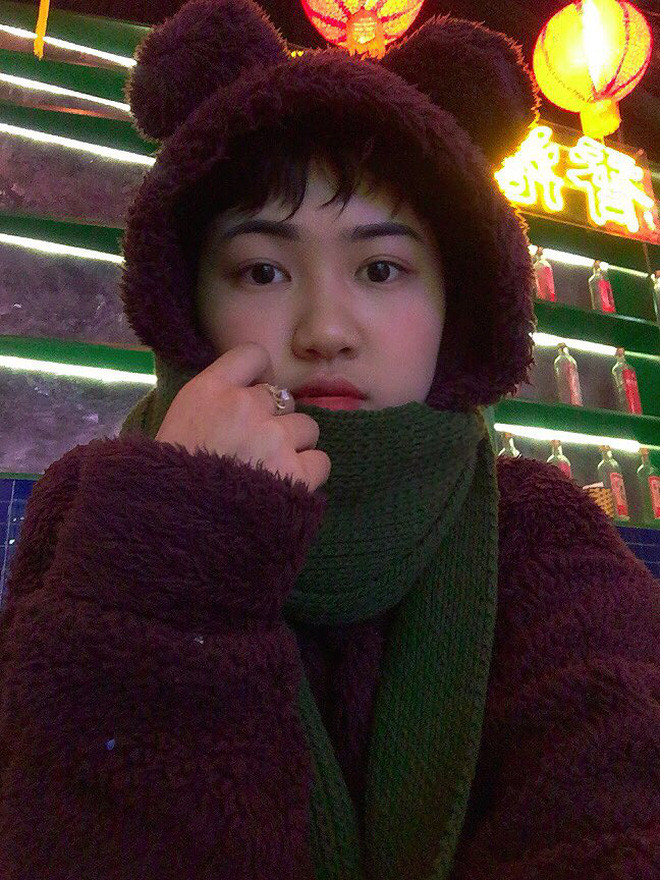 Nữ sinh 18 tuổi mắc ung thư phổi: "chỉ vuốt tóc 15 phút nhưng mình trọc cả mái đầu" - Hình 9 Nu sinh 18 tuoi mac ung thu phoi: