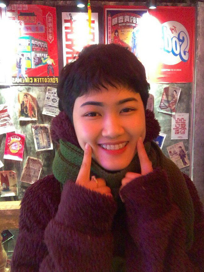 Nữ sinh 18 tuổi mắc ung thư phổi: "chỉ vuốt tóc 15 phút nhưng mình trọc cả mái đầu" - Hình 11 Nu sinh 18 tuoi mac ung thu phoi: