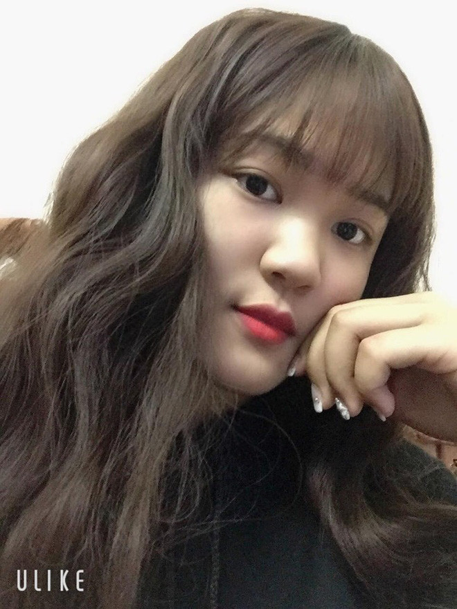 Nữ sinh 18 tuổi mắc ung thư phổi: "chỉ vuốt tóc 15 phút nhưng mình trọc cả mái đầu" - Hình 7 Nu sinh 18 tuoi mac ung thu phoi: