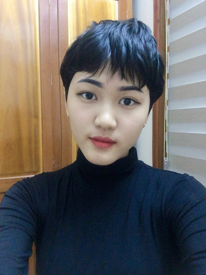 Nữ sinh 18 tuổi mắc ung thư phổi: "chỉ vuốt tóc 15 phút nhưng mình trọc cả mái đầu" - Hình 8 Nu sinh 18 tuoi mac ung thu phoi: