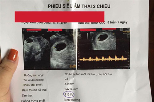 Tố vợ cũ của chồng phá hoại hạnh phúc gia đình To vo cu cua chong pha hoai hanh phuc gia dinh