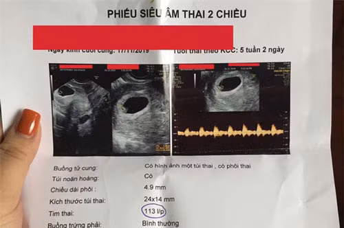 Tố vợ cũ của chồng phá hoại hạnh phúc gia đình To vo cu cua chong pha hoai hanh phuc gia dinh