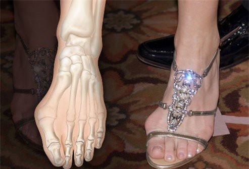 Chị em đi giày cao gót để đẹp nhưng khiến bộ phận này đau đớn - Hình 2 Chi em di giay cao got de dep nhung khien bo phan nay dau don-Hinh-2