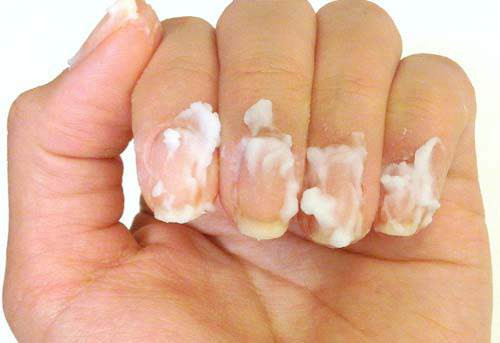 Tat tan tat cong dung lam dep cua dau dua va tac hai neu dung sai-Hinh-8