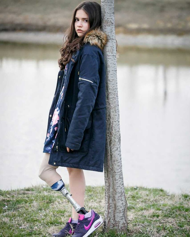 Biljana truyền cảm hứng cho giới trẻ qua những bài phát biểu thúc đẩy động lực về việc nhận thức giá trị của bản thân sau khi bị cắt bỏ chân trái trong quá trình điều trị ung thư.