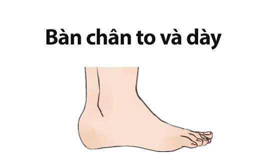 Tướng bàn chân phụ nữ cả đời hưởng trọn vinh hoa phú quý - Hình 3 Tuong ban chan phu nu ca doi huong tron vinh hoa phu quy-Hinh-3