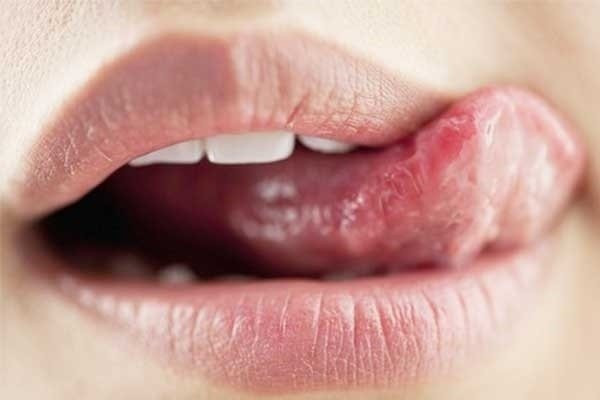 Nguyen nhan khien lan moi cua ban ngay cang kho