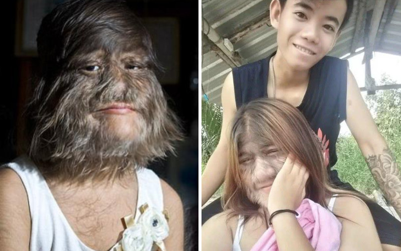 Co gai nguoi soi da huy hon, khoe ban trai moi day ngot ngao-Hinh-2