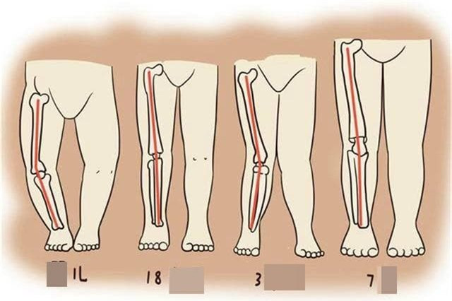 Nhung bo phan cua tre so sinh cang xau thi the luc cang tot-Hinh-4