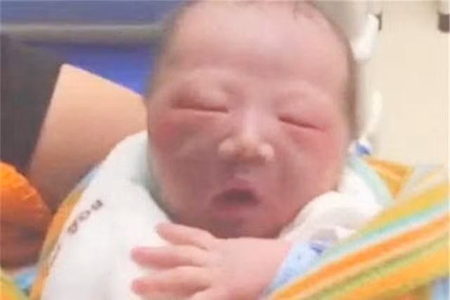 Nhung bo phan cua tre so sinh cang xau thi the luc cang tot