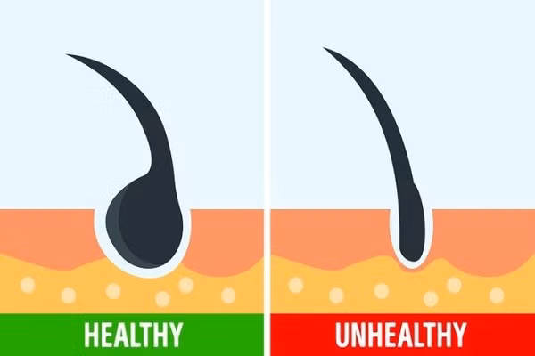 Muon biet toc khoe manh hay khong hay thu ngay 4 bai kiem tra nay