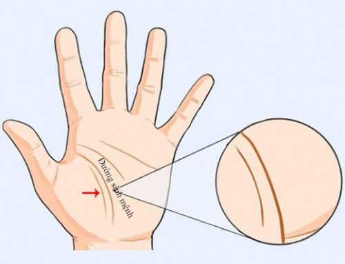 Tướng bàn tay phụ nữ biết ngay số sướng - khổ - Hình 2 Tuong ban tay phu nu biet ngay so suong - kho-Hinh-2