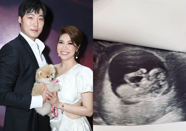 Pha Le 3 lan say thai, tiem hormone vao bung vi 'khat con' o tuoi 33