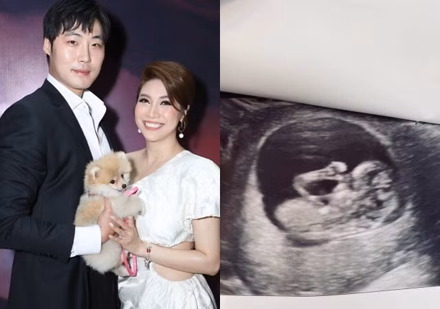 Pha Le 3 lan say thai, tiem hormone vao bung vi 'khat con' o tuoi 33