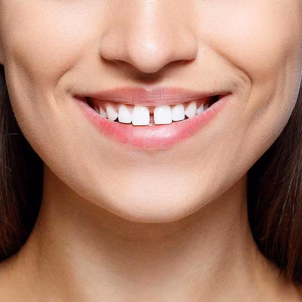 3 tuong rang chung to so kho, bi thi phi deo bam khong thoi