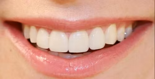 Nhin diem nay doan ngay van menh giau sang hay khon kho