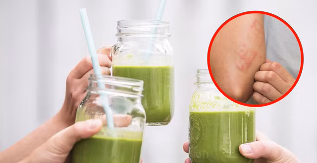 5 nhóm người không nên cùng nước ép cần tây - Hình 3 5 nhom nguoi khong nen cung nuoc ep can tay-Hinh-3