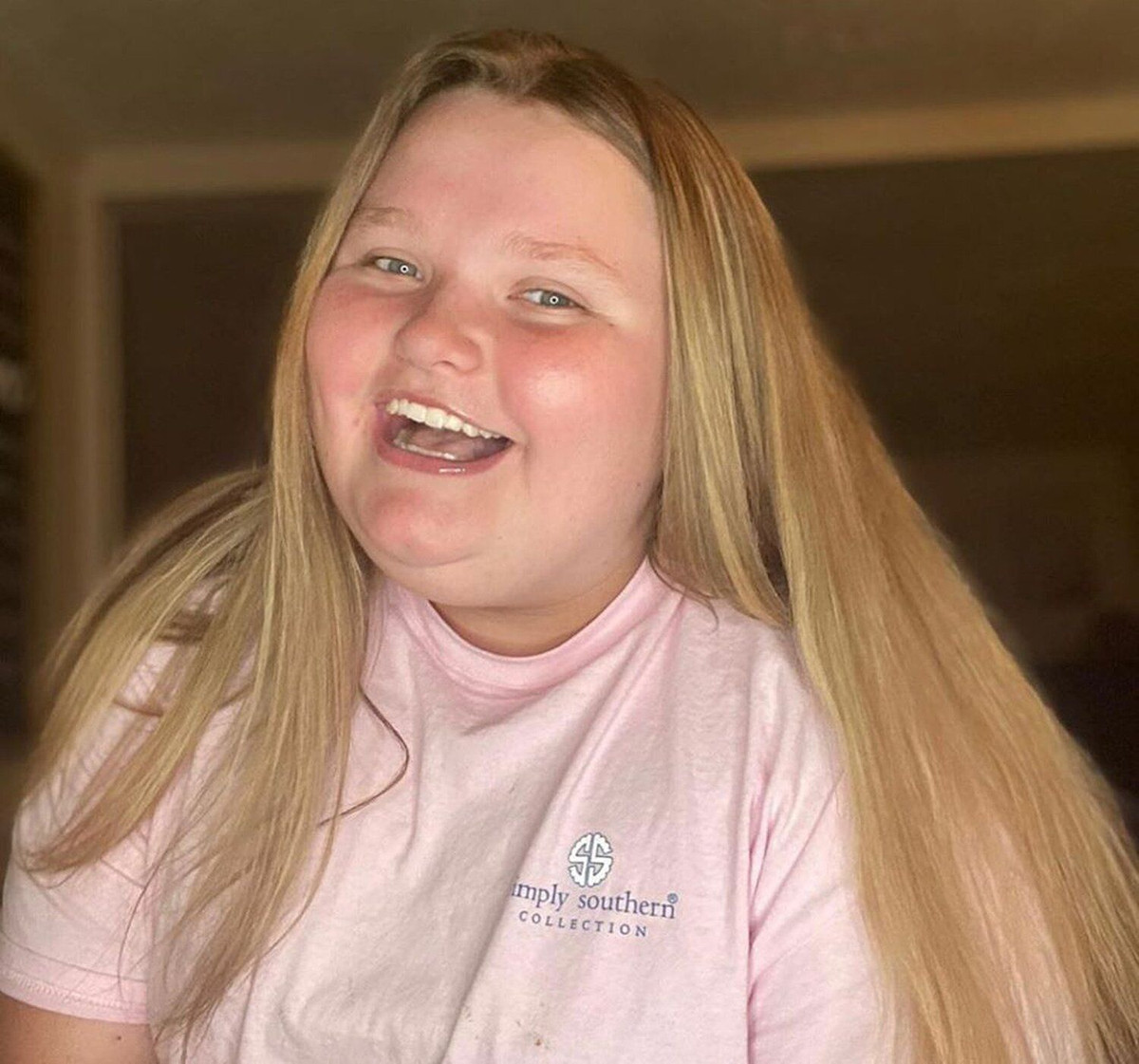 Từ nhỏ, Alana đã nổi tiếng với ngoại hình mũm mĩm, đáng yêu. Cô bé cũng nổi tiếng với những câu nói hài hước về ngoại hình của mình như: "Lần cuối cùng tôi ăn salad là chưa bao giờ" hay "Xinh đẹp có nhiều hình dáng khác nhau và hình dáng của tôi thuộc loại dễ thương"... Tuy nhiên, càng lớn Alana càng có dấu hiệu tăng cân mất kiểm soát. Lên 10 tuổi, cô bé bắt đầu vật lộn với bệnh béo phì, khiến người hâm mộ không nhận ra vì ngoại hình phát tướng, thừa cân.