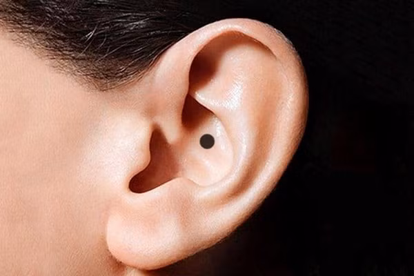 ##bc### Nốt ruồi ở tai: Nếu một người có nốt ruồi phía trên tai sẽ không ảnh hưởng đến ngoại hình mà ngược lại còn tăng thêm vận may cho người đó. Nốt ruồi ở trên tai biểu thị tài vận dồi dào, đặc biệt là vận may trời ban. Nốt ruồi ở vị trí này tương đối ẩn nhưng cũng sẽ tăng thêm vẻ quyến rũ cho người phụ nữ. 