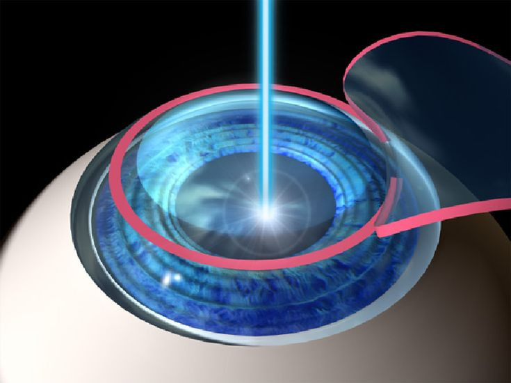  10. Ứng dụng rộng rãi trong y học. Laser được sử dụng để phẫu thuật mắt (LASIK), loại bỏ sỏi thận, điều trị ung thư, xóa xăm, triệt lông, và cắt mô chính xác trong phẫu thuật. Ảnh: Pinterest.