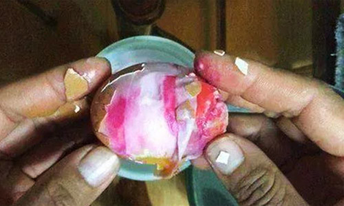 Quả trứng bị nghi là trứng giả Trung Quốc chứa HIV.