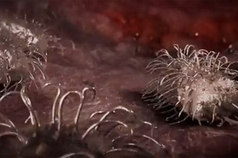 Với “vũ khí” lợi hại là bộ răng sắc nhọn, vi khuẩn có thể huỷ hoại, ăn mòn tế bào chỉ trong 1 thời gian ngắn. Nhiều người buộc phải cắt bỏ các bộ phận trên cơ thể mình do sự tấn công rầm rộ của chúng.