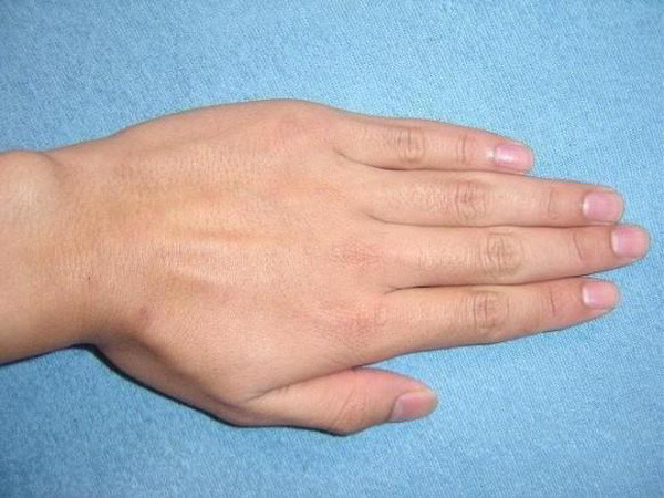 A. Không có khe. Bạn là người sống rất tình cảm, tính tình chững chạc, ổn định, làm việc ngăn nắp, suy nghĩ cẩn thận, người như vậy là người đàn ông tốt, chăm lo cho gia đình trong hôn nhân, nữ là người đảm đang, quản lý nhà cửa tốt.