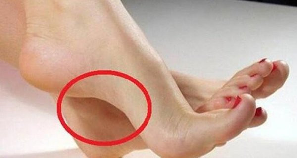 Nhìn tướng bàn chân biết ngay ai giàu sang, ai nghèo khó Nhin tuong ban chan biet ngay ai giau sang, ai ngheo kho