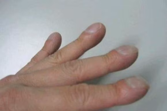 Phoi co tot hay khong, nhin ban tay de nhan biet!