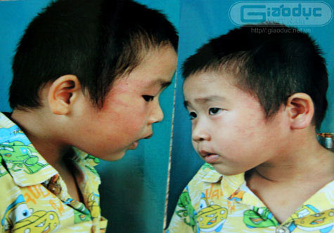 Ngày 5/9/2011, ngày đầu tiên các bé tới trường và bắt đầu năm học mới, cháu Nguyễn Khánh An, 4 tuổi, con chị Mai Thị Tâm, trú tại Phù Lãm, Hà Đông, Hà Nội đã bị cô giáo tát sưng phù, đỏ lằn mặt. Ở bên má phải của cháu hằn những đầu ngón tay, quần mắt có vệt đọng máu.