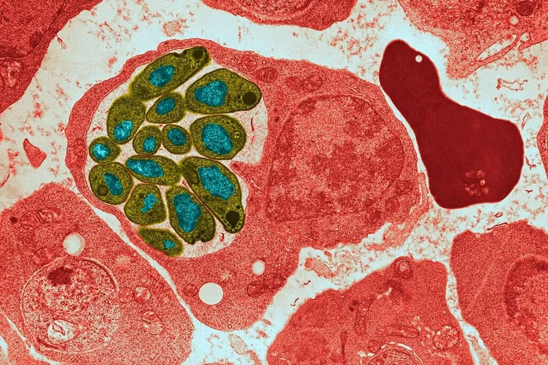 Theo WHO, khoảng 80% số ca tử vong do sốt rét ở châu Phi là trẻ em dưới 5 tuổi.