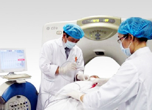 Để tránh buồn nôn cho các bệnh nhân điều trị ung thư, người ta thường dùng tới liệu pháp châm cứu.