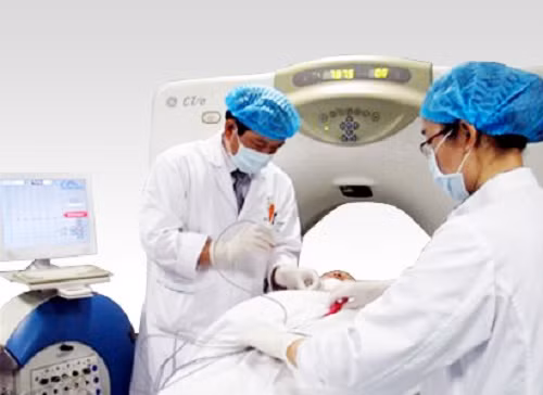 Để tránh buồn nôn cho các bệnh nhân điều trị ung thư, người ta thường dùng tới liệu pháp châm cứu.