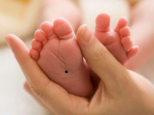 Dua tre co not ruoi o vi tri nay, tai loc giau sang un un den