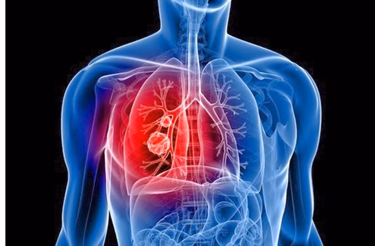 Phổi. Lão hóa từ tuổi 20. Dung tích của phổi bắt đầu giảm dần từ tuổi 20. Ðến tuổi 40, một số yếu tố như lồng ngực biến dạng, các khớp bị cứng, nhu mô phổi giảm đàn hồi... kết hợp với sự xơ cứng ở cơ bắp và xương sườn buồng phổi có thể khiến cho nhiều người bị khó thở.