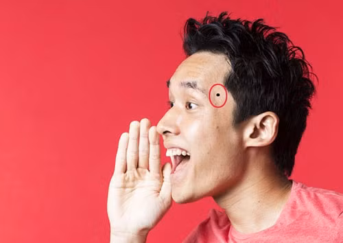 br/> 3. Nốt ruồi ở Thái Dương: Huyệt Thái Dương còn được gọi là cung Dịch Mã, từ vị trí này mà xem tướng khuôn mặt thì có thể biết được những điềm báo về việc di chuyển của bản mệnh, từ du lịch, công tác đến xa quê lập nghiệp hay di dân… 