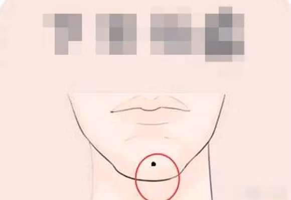 Phu nu co nam not ruoi thi giau to, cuoc song sung tuc-Hinh-3