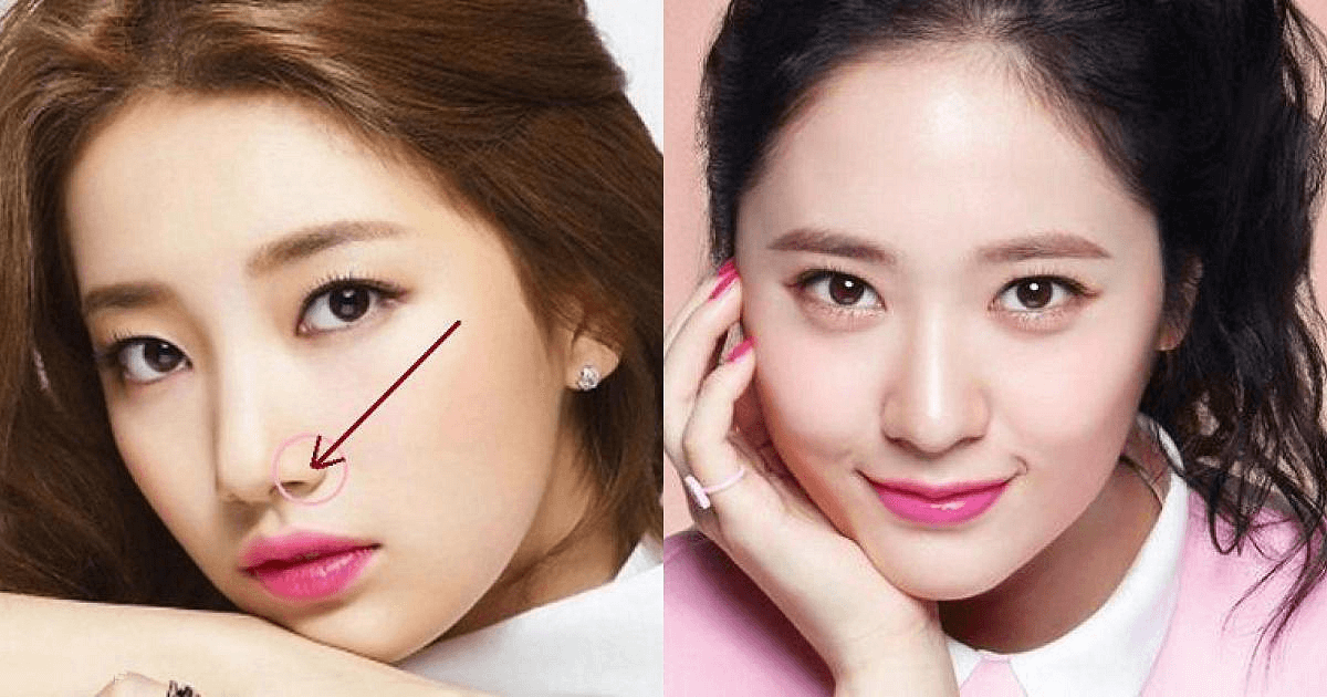  Mũi củ tỏi: Nếu xét về mặt thẩm mỹ, mũi củ tỏi không phải là một chiếc mũi đẹp vì có sống vừa cao vừa nhỏ nhắn, hai cánh mũi mỏng nhưng đầu mũi lại to tròn. 