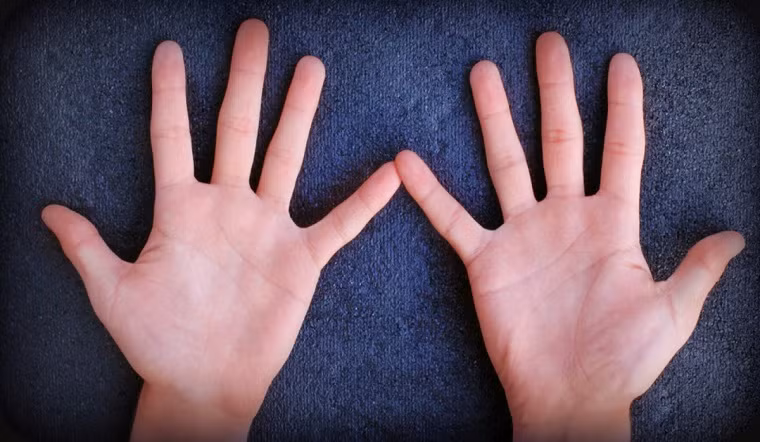  Ngón tay thô: Mặc dù ngón tay thon dài búp măng được xem như "chuẩn mực" của cái đẹp nhưng khi xét về nhân tướng học, người có ngón tay vừa ngắn vừa thô lại có cuộc sống thuận buồm xuôi gió hơn người. 